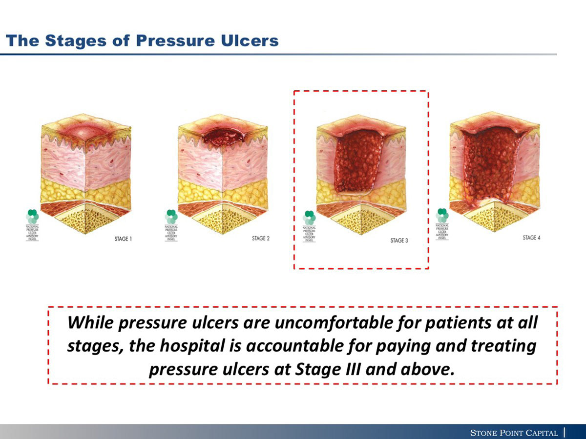 Alexandre Jais - Pressure Ulcer Prevention - Biodesign