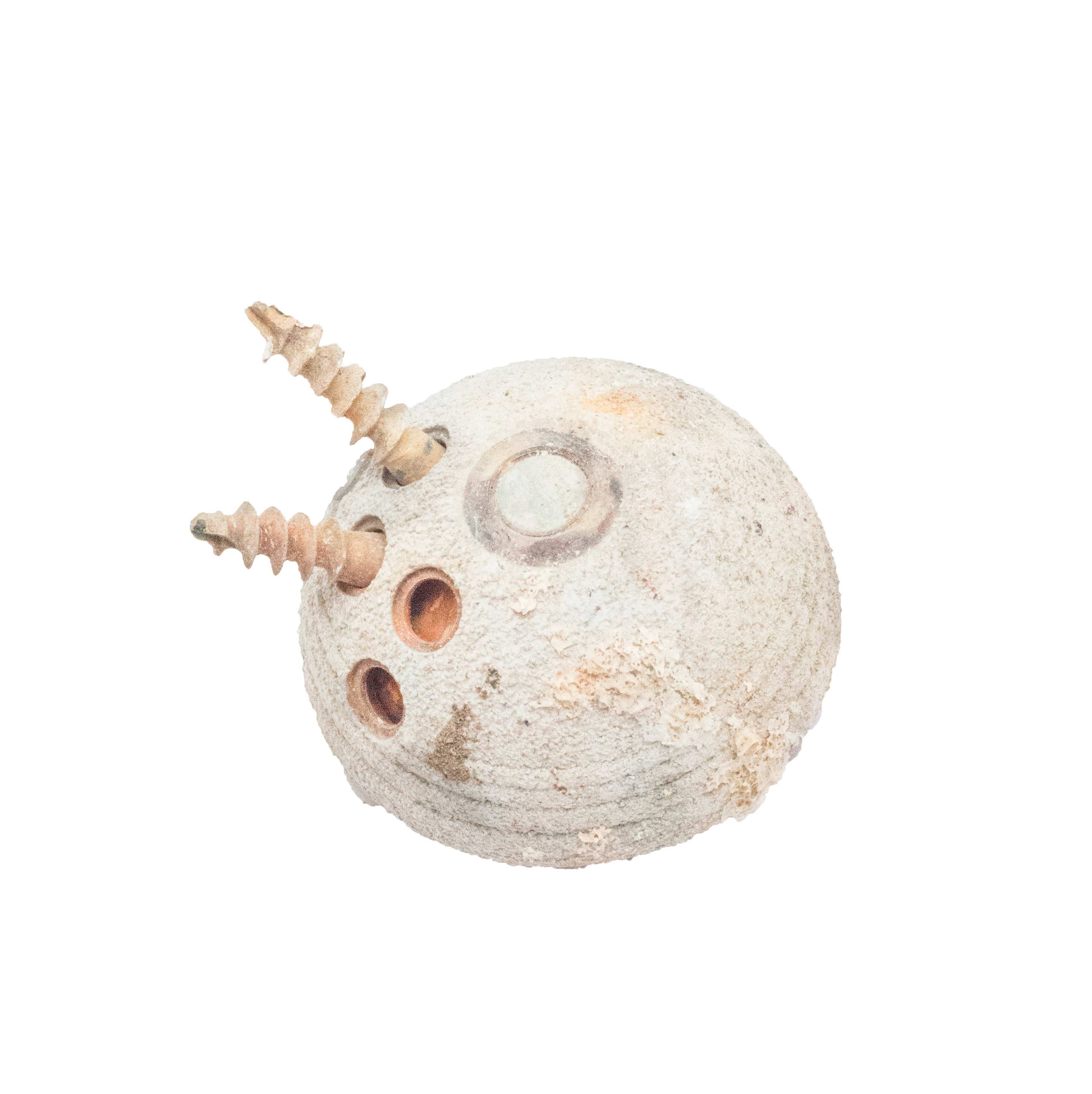 Hip replacement: Acetabular components