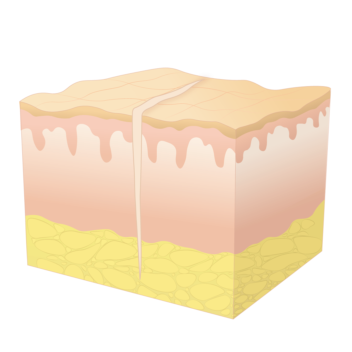 Alexandra Altamuro - Wound Healing Diagrams