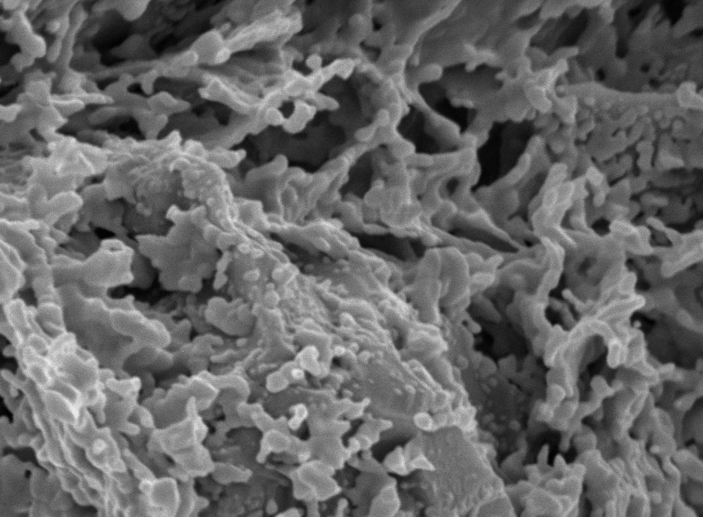 Microstructural characterization