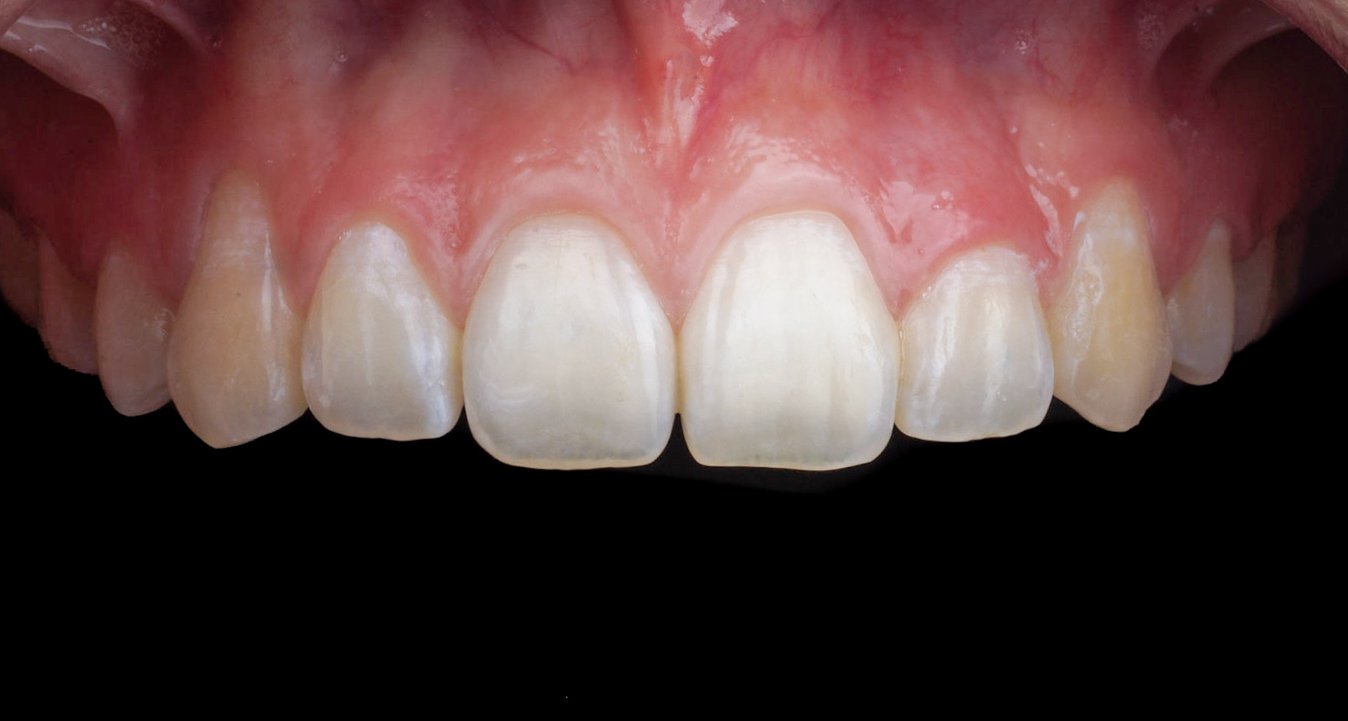 Milivoj Sherrington Dental Photography