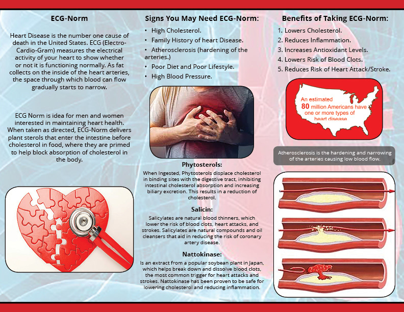 ECG-Norm Side B
