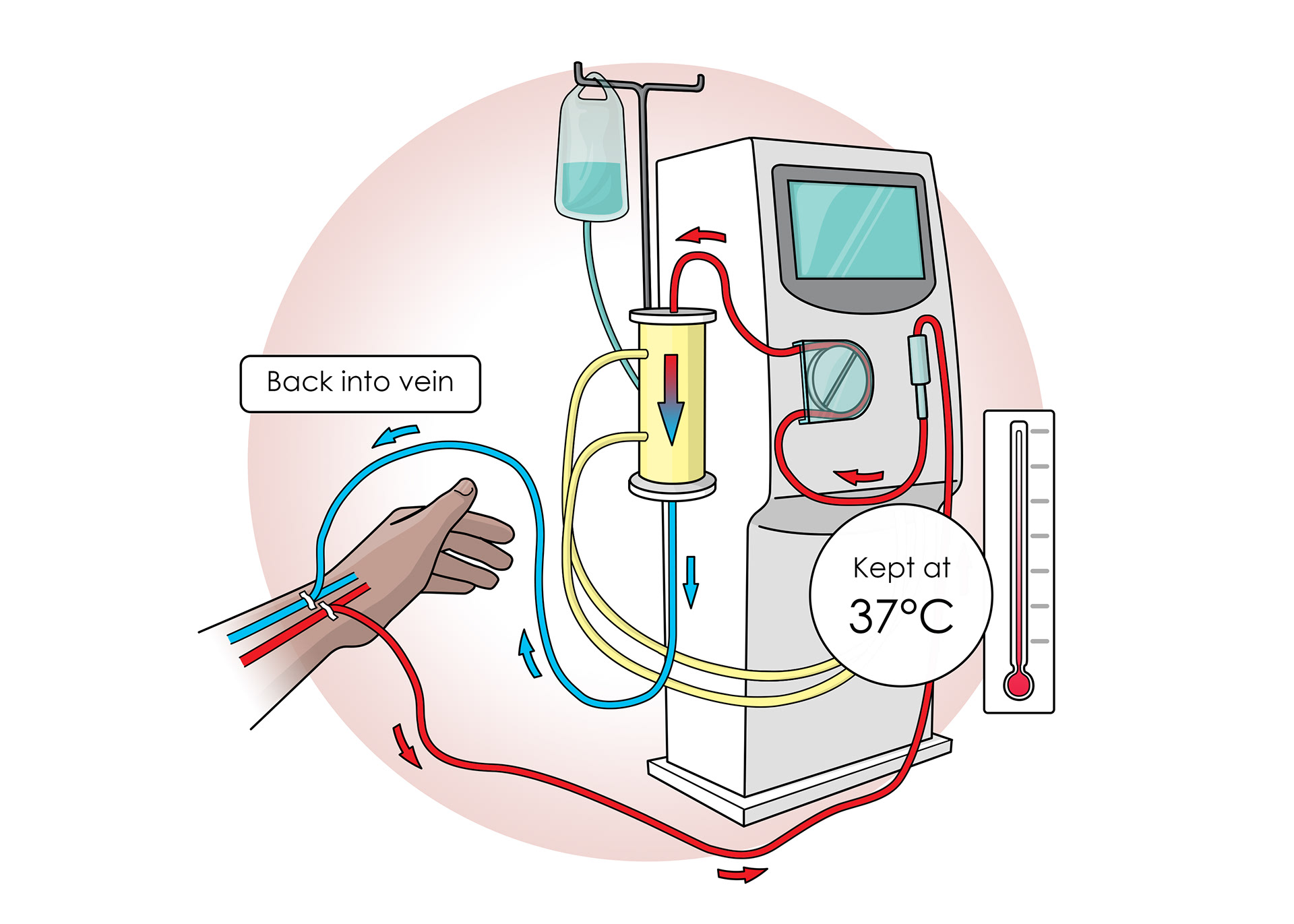 The machine keeps the blood at the correct temperature