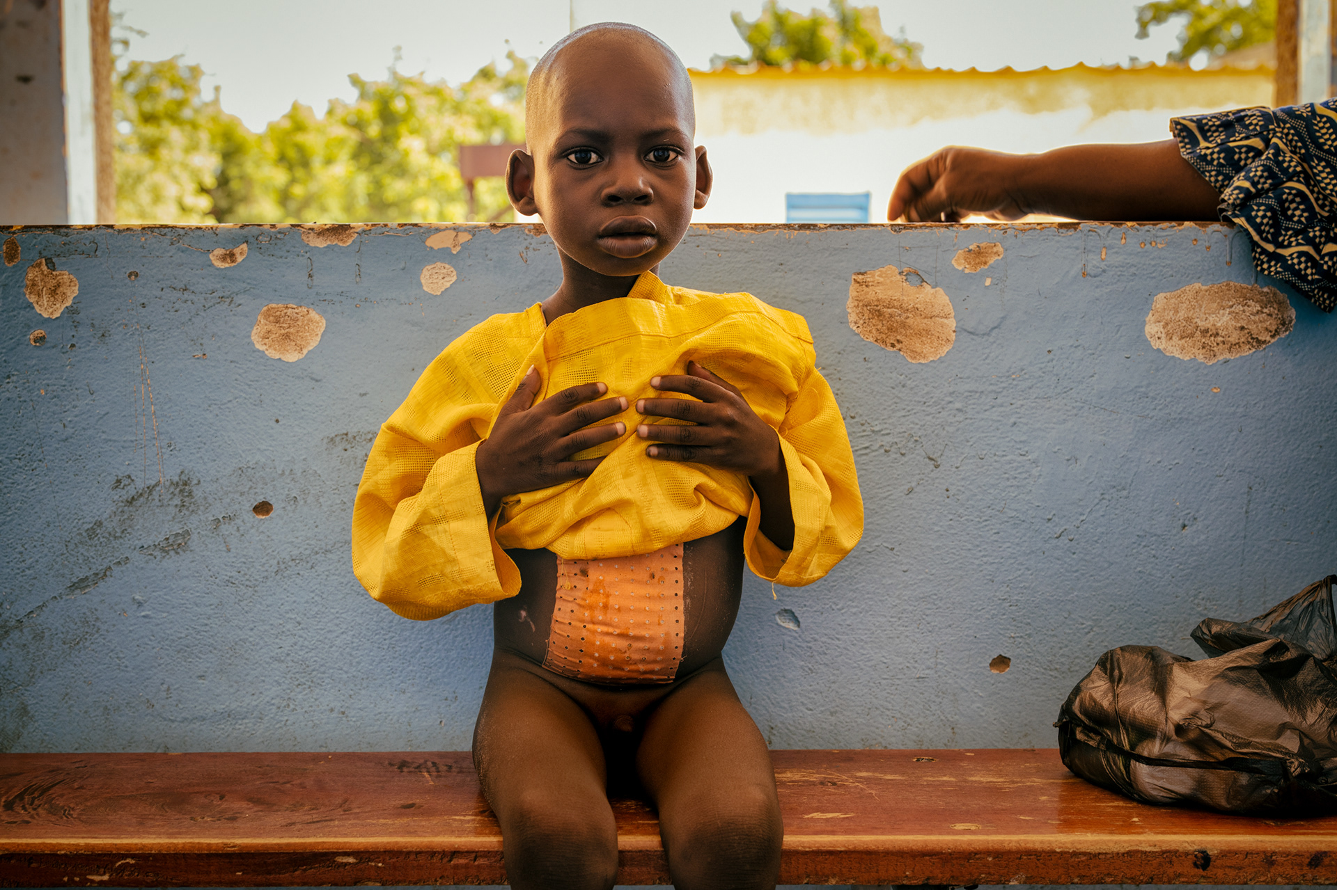 Hunger – Niger