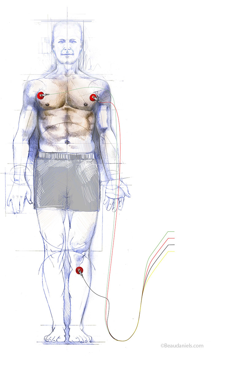 Heart monitoring.